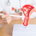 SUS vai ofertar novos tratamentos para endometriose