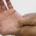 Reumatismo 3010202518