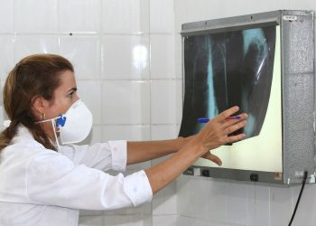 Tuberculose