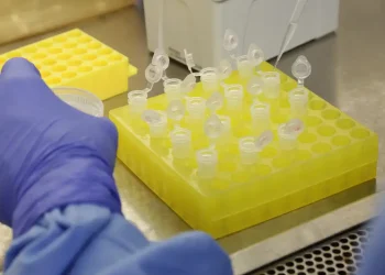 Diagnostico Laboratorial De Casos Suspeitos Do Novo Coronavirus 2801209411